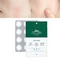 VT Cosmetics Cica Care Spot Patch Патчі проти висипань — зображення 2